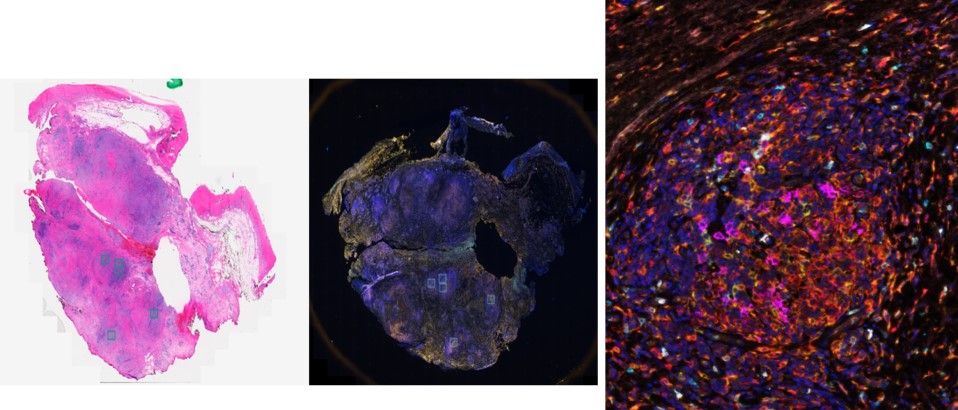 noplasias herramientas 1